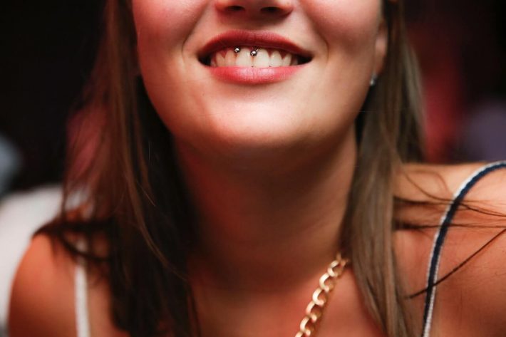 Hiperdoncja – czy dodatkowe zęby należy usunąć?