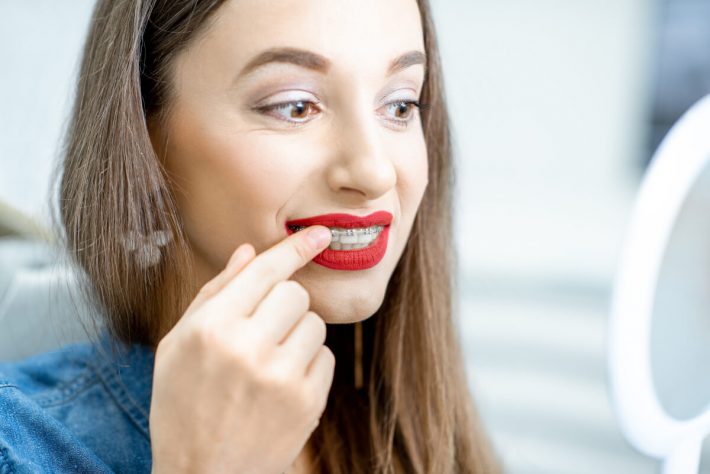 Rodzaje aparatów ortodontycznych – na który się zdecydować?